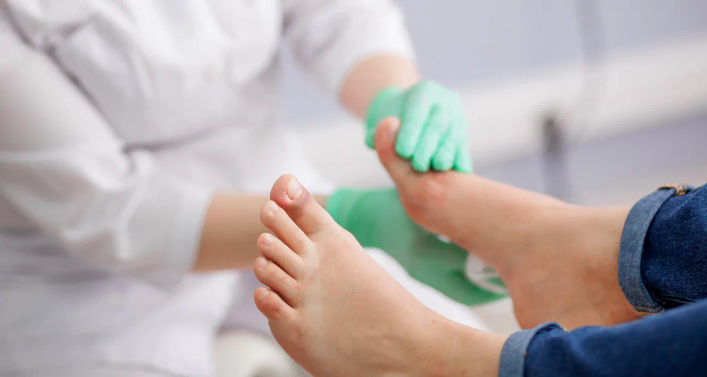 Conheça os principais cuidados com o pé diabético​ para pacientes em Home Care